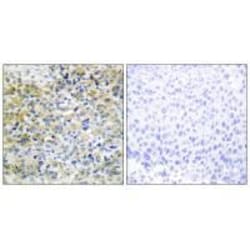 Invitrogen CARKL Polyclonal Antibody 100 &mu;L; Unconjugated:Antibodies,