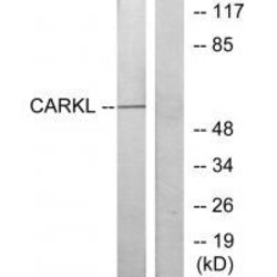 Invitrogen CARKL Polyclonal Antibody 100 &mu;L | Buy Online | Invitrogen&trade; | Fisher Scientific