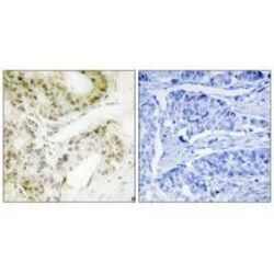 Invitrogen MED13 Polyclonal Antibody 100 &mu;L; Unconjugated:Antibodies,