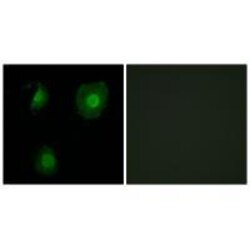 Invitrogen EID1 Polyclonal Antibody 100 &mu;L; Unconjugated:Antibodies,