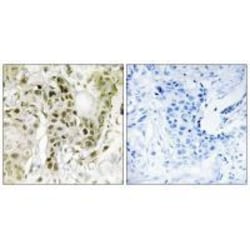 Invitrogen BCOR Polyclonal Antibody 100 &mu;L | Buy Online | Invitrogen&trade; | Fisher Scientific