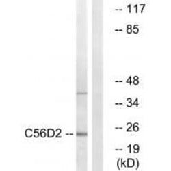 Invitrogen CYB561D2 Polyclonal Antibody 100 &mu;L | Buy Online | Invitrogen&trade; | Fisher Scientific