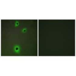 Invitrogen CADM4 Polyclonal Antibody 100 &mu;L; Unconjugated:Antibodies,