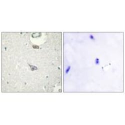 Invitrogen CADM4 Polyclonal Antibody 100 &mu;L; Unconjugated:Antibodies,