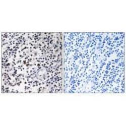 Invitrogen DCL-1 Polyclonal Antibody 100 &mu;L; Unconjugated:Antibodies,