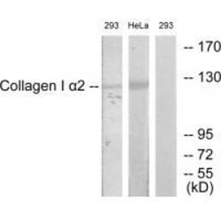 Invitrogen COL1A2 Polyclonal Antibody 100 &mu;L | Buy Online | Invitrogen&trade; | Fisher Scientific