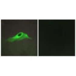 Invitrogen COL4A5 Polyclonal Antibody 100 &mu;L; Unconjugated:Antibodies,