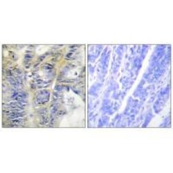 Invitrogen COL4A5 Polyclonal Antibody 100 &mu;L; Unconjugated:Antibodies,