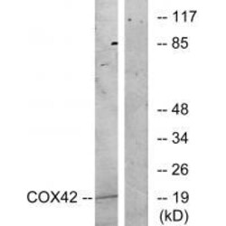 Invitrogen COX4I2 Polyclonal Antibody 100 &mu;L | Buy Online | Invitrogen&trade; | Fisher Scientific