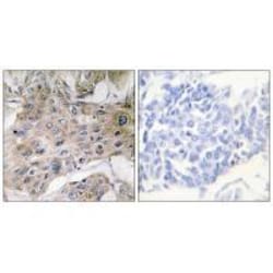 Invitrogen COX7A2 Polyclonal Antibody 100 &mu;L; Unconjugated:Antibodies,