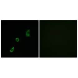 Invitrogen FGF23 Polyclonal Antibody 100 &mu;L; Unconjugated:Antibodies,