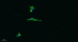 Invitrogen Laminin alpha-5 Polyclonal Antibody 100 &mu;L | Buy Online | Invitrogen&trade; | Fisher Scientific