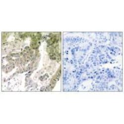 Invitrogen Laminin alpha-5 Polyclonal Antibody 100 &mu;L | Buy Online | Invitrogen&trade; | Fisher Scientific