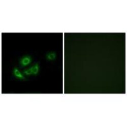 Invitrogen MRPL11 Polyclonal Antibody 100 &mu;L; Unconjugated:Antibodies,