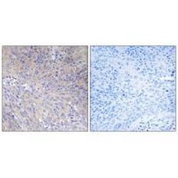 Invitrogen MRPL11 Polyclonal Antibody 100 &mu;L; Unconjugated:Antibodies,