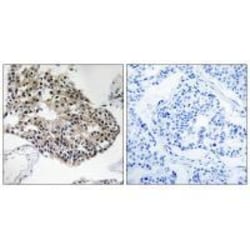 Invitrogen RPS25 Polyclonal Antibody 100 &mu;L; Unconjugated:Antibodies,