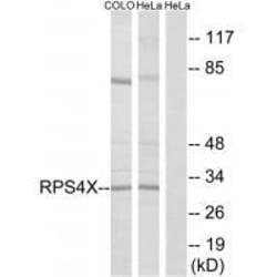 Invitrogen RPS4X Polyclonal Antibody 100 &mu;L | Buy Online | Invitrogen&trade; | Fisher Scientific