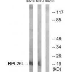 Invitrogen RPL26L1 Polyclonal Antibody 100 &mu;L; Unconjugated:Antibodies,