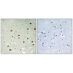 Invitrogen ABHEB Polyclonal Antibody 100 &mu;L; Unconjugated:Antibodies,