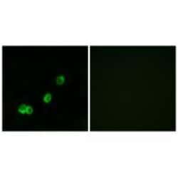 Invitrogen ACOT1 Polyclonal Antibody 100 &mu;L; Unconjugated:Antibodies,