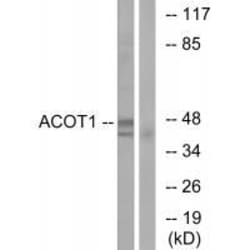Invitrogen ACOT1 Polyclonal Antibody 100 &mu;L; Unconjugated:Antibodies,