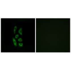 Invitrogen ACOT12 Polyclonal Antibody 100 &mu;L; Unconjugated:Antibodies,