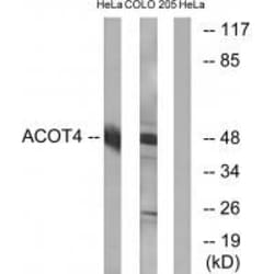 Invitrogen ACOT4 Polyclonal Antibody 100 &mu;L; Unconjugated:Antibodies,