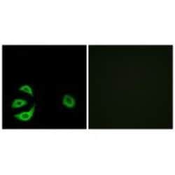 Invitrogen ACOT8 Polyclonal Antibody 100 &mu;L; Unconjugated:Antibodies,