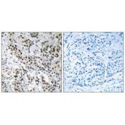 Invitrogen APBB2 Polyclonal Antibody 100 &mu;L; Unconjugated:Antibodies,