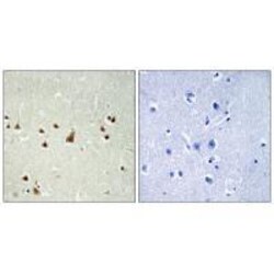 Invitrogen ANKRD26 Polyclonal Antibody 100 &mu;L; Unconjugated:Antibodies,