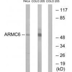 Invitrogen ARMC6 Polyclonal Antibody 100 &mu;L | Buy Online | Invitrogen&trade; | Fisher Scientific