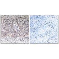 Invitrogen Arylsulfatase A Polyclonal Antibody 100 &mu;L; Unconjugated:Antibodies,