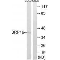 Invitrogen HGH1 Polyclonal Antibody 100 &mu;L; Unconjugated:Antibodies,