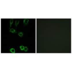 Invitrogen Calponin 2 Polyclonal Antibody 100 &mu;L; Unconjugated:Antibodies,