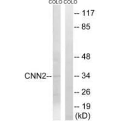 Invitrogen Calponin 2 Polyclonal Antibody 100 &mu;L; Unconjugated:Antibodies,