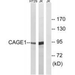 Invitrogen CAGE1 Polyclonal Antibody 100 &mu;L | Buy Online | Invitrogen&trade; | Fisher Scientific