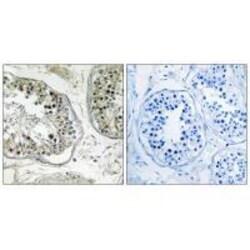 Invitrogen CHST13 Polyclonal Antibody 100 &mu;L; Unconjugated:Antibodies,