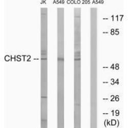 Invitrogen CHST2 Polyclonal Antibody 100 &mu;L | Buy Online | Invitrogen&trade; | Fisher Scientific