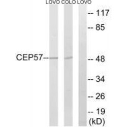 Invitrogen CEP57 Polyclonal Antibody 100 &mu;L | Buy Online | Invitrogen&trade; | Fisher Scientific