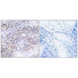 Invitrogen CLN6 Polyclonal Antibody 100 &mu;L; Unconjugated:Antibodies,