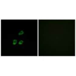 Invitrogen CLCN4 Polyclonal Antibody 100 &mu;L; Unconjugated:Antibodies,