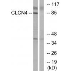 Invitrogen CLCN4 Polyclonal Antibody 100 &mu;L; Unconjugated:Antibodies,