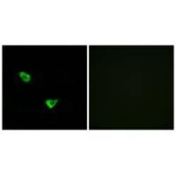 Invitrogen CHPF Polyclonal Antibody 100 &mu;L; Unconjugated:Antibodies,