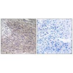 Invitrogen CHPF Polyclonal Antibody 100 &mu;L; Unconjugated:Antibodies,