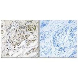 Invitrogen CDYL2 Polyclonal Antibody 100 &mu;L; Unconjugated:Antibodies,