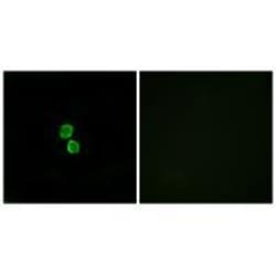 Invitrogen CMTM1 Polyclonal Antibody 100 &mu;L; Unconjugated:Antibodies,