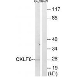 Invitrogen CMTM6 Polyclonal Antibody 100 &mu;L | Buy Online | Invitrogen&trade; | Fisher Scientific