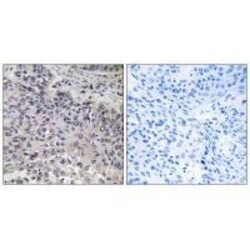 Invitrogen C1QC Polyclonal Antibody 100 &mu;L; Unconjugated:Antibodies,
