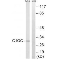 Invitrogen C1QC Polyclonal Antibody 100 &mu;L | Buy Online | Invitrogen&trade; | Fisher Scientific