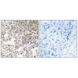Invitrogen NCAPG2 Polyclonal Antibody 100 &mu;L; Unconjugated:Antibodies,
